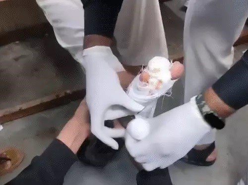  અમરેલીમાં શ્વાનનો આતંક, એક જ દિવસમાં 3૦થી વધારે લોકોને કરડયા