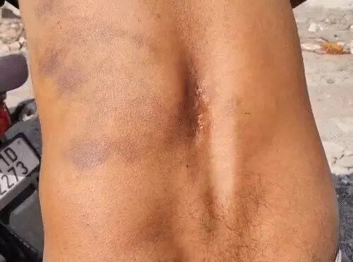 જૂનાગઢના યુવાનનું તાંત્રિક વિધિના બહાને અપહરણ કરી નનામીમાં બાંધી ડામ આપ્યા