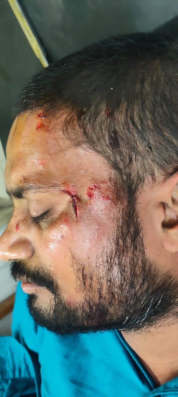  ઉનામાં મલ્હાર ઢોસાના માલિકે કોળી સમાજની દીકરી પર હુમલો કર્યાના આક્ષેપ