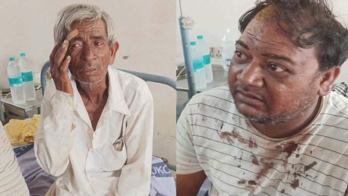 2 રૂપિયાની બીડીનો ઝઘડો લોહિયાળ બન્યો: ગોંડલના દેવડા ગામે પિતા-પુત્ર પર હુમલો